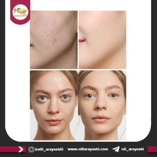 کانسیلر مایع تیوپی فیت شیم کیس بیوتی کد 68159-03