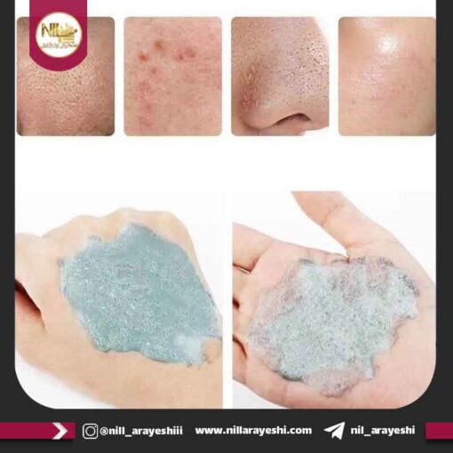ماسک حبابی بلوبری و هیالورونیک اسید سرسان لاو کد xg0643