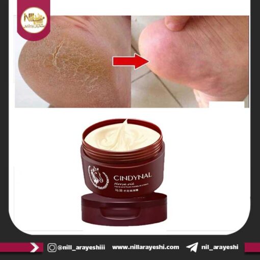 کرم کاسه ای دست و پا روغن اسب سيندينال کد xdne25666