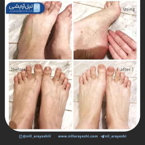 اسپری لایه بردار پا روغن پوست پرتقال گرافیکو