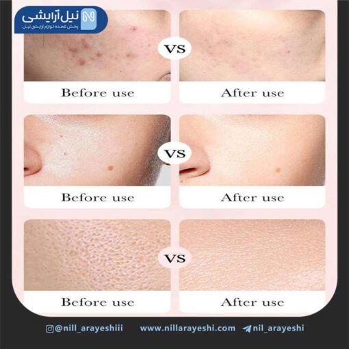 فوم شستشو صورت تیوپی گل رز بیوآکوا کد bqy60551