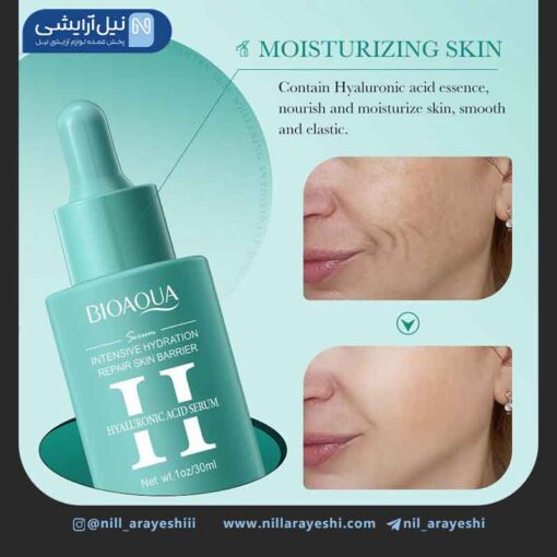 سرم صورت هیالورونیک اسید بیوآکوا 30 میل کد Bqy00768